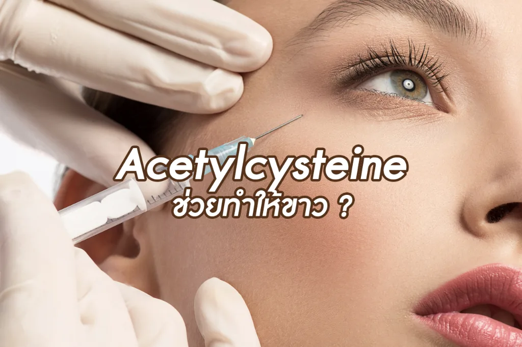 Acetylcysteine ช่วยทำให้ขาว?