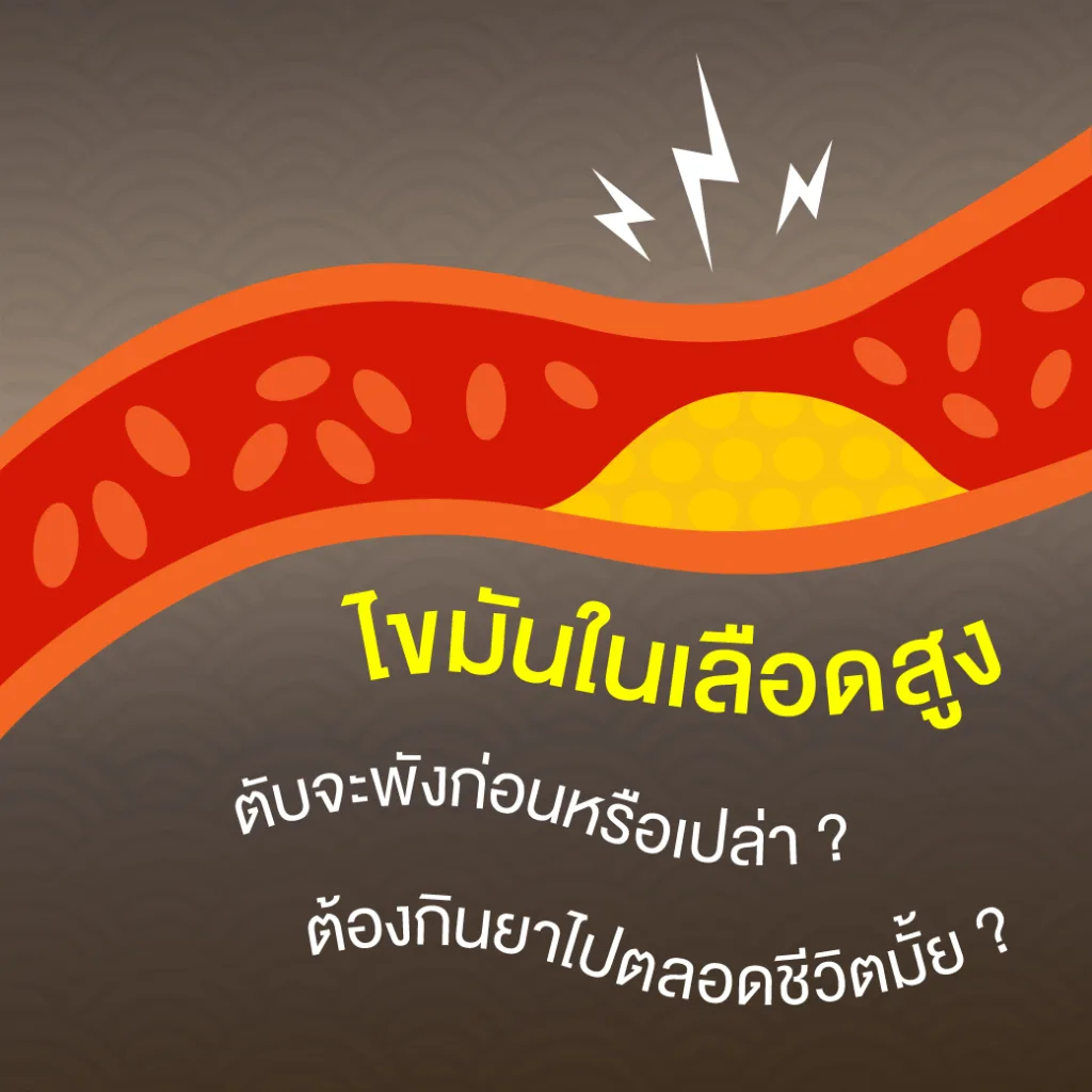 ไขมันในเลือดสูง ต้องกินยาไปตลอดชีวิตมั้ย ? ตับจะพังก่อนหรือเปล่า