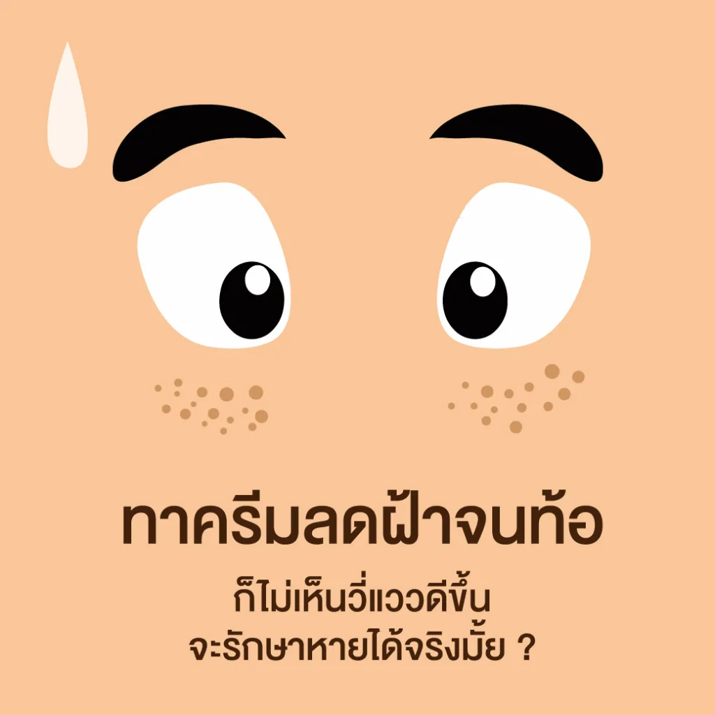 ทาครีมลดฝ้าจนท้อ ก็ไม่เห็นวี่แววดีขึ้น จะรักษาหายได้จริงมั้ย?